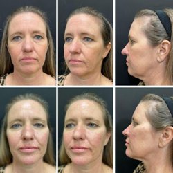 Serenity MD Temecula - Day of: Before and After Photos