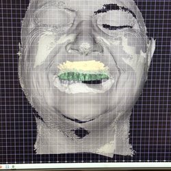 Fusion Dental Implants - Full Arch Center - Facial scan image