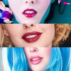 Laser Sculpture - Lip injection evolution with Shahla. Top is unfilled. Middle has restylane injections and most recent injections is the bottom photo.