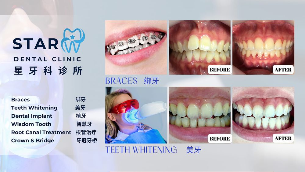 STAR DENTAL CLINIC PENANG 95G, Jalan Perniagaan Gemilang 1,, Bukit