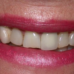 Smiles Dental Design - Before Smile