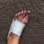 Photo of Morse Upshaw - Advanced Foot Care Center