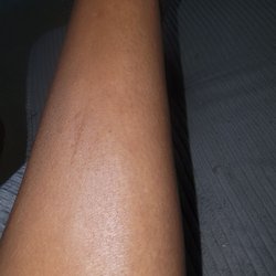 Spirit Halloween - Leg burn