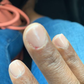 Galaxy Nails - Bleeding cuticle - Nail Salons Near Me - Miami, Florida