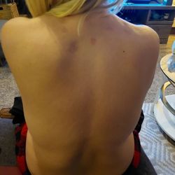Nevada Pain Care - ATROPHY....