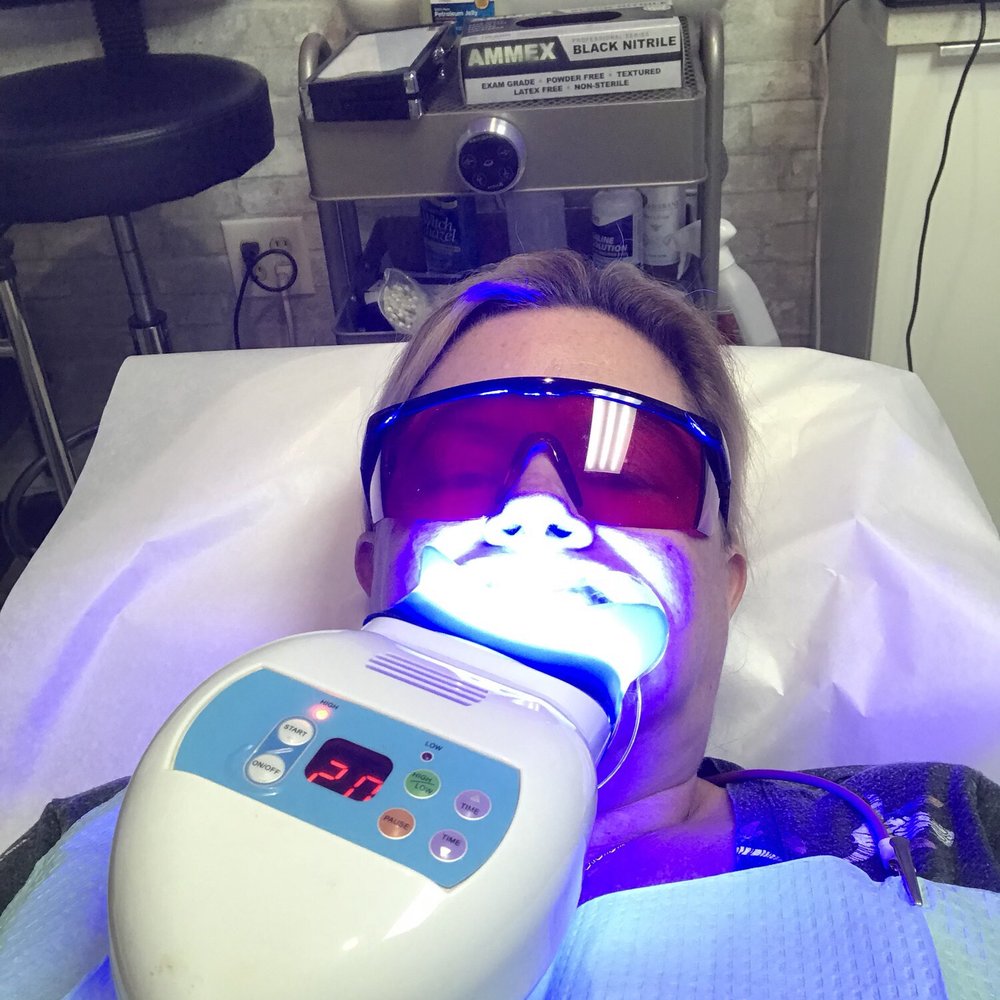 Instant Beauty Spa - Teeth Whitening Near Me - Phoenix, Arizona