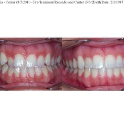 Quintero Orthodontics - My results :o)