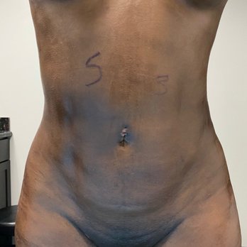 Innovative Healing Spa - Abs popping out, still look at that detailed work & notations! - Massage Therapy Near Me - Houston, Texas