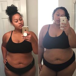Adam Murdock, MD Murdock Health - After and Before using Dr. Murdock's, weight loss plan!! Can't wait to see where the next few months take me.