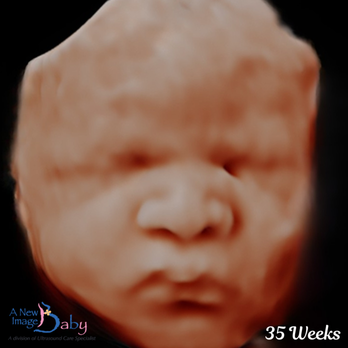 A New Image Baby - HD(5D) Baby Ultrasound
35 Weeks - Diagnostic Imaging Near Me - Orlando, Florida A New Image Baby - HD(5D) Baby Ultrasound
35 Weeks - Diagnostic Imaging Near Me - Orlando, Florida