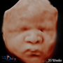 Photo of A New Image Baby