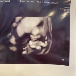 Goldenview Ultrasound 3d/4d/HD Boston MA - Baby in HD