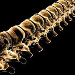 Spine Institute Northwest