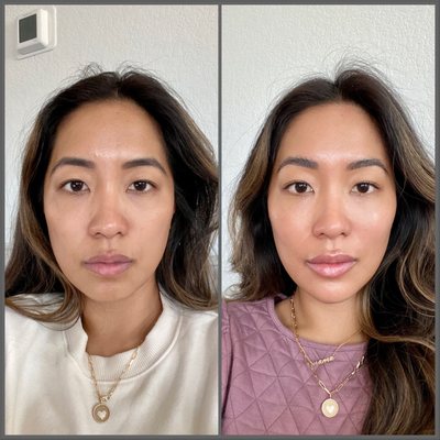 The Fitz Aesthetic Club by null