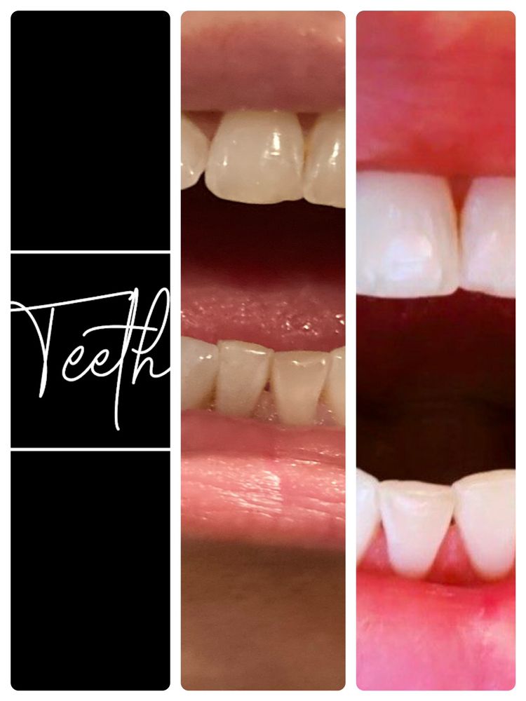 The White Teeth Company Logo