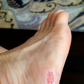 Vivi Nails - This is what happened during a pedicure they cut me so badly. - Massage Near Me - Riverhead, New York Vivi Nails - This is what happened during a pedicure they cut me so badly. - Massage Near Me - Riverhead, New York
