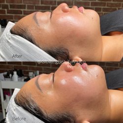 Glowing Beauty & Co. - Dermaplane + HydraFacial
..
Want glowing skin? This is the perfect combo for that.