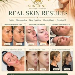 Sunshine Wellness and Aesthetics