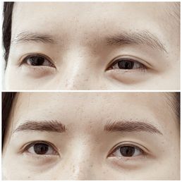 Immediate before and after Immediate before and after