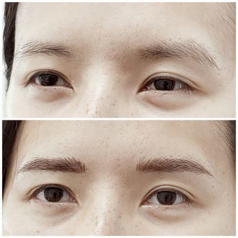 By Soo Cosmetic Tattoo - Immediate before and after - Permanent Makeup Near Me - Arcadia, California By Soo Cosmetic Tattoo - Immediate before and after - Permanent Makeup Near Me - Arcadia, California