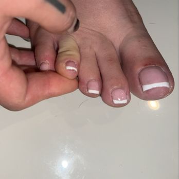 Dazz Nails and Spa - Cuts under my nails from clippers - Nail Salons Near Me - Placentia, California