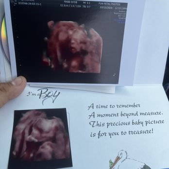 Fun Fetal Photos - Diagnostic Imaging Near Me - Hampton, Virginia Fun Fetal Photos - Diagnostic Imaging Near Me - Hampton, Virginia