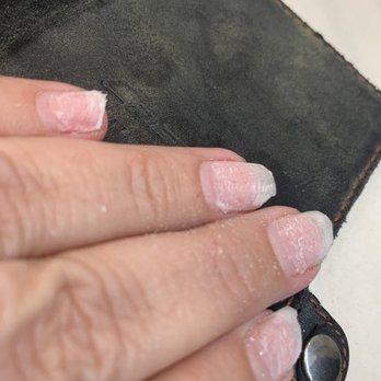 Utopia Nail & Spa - What the looked like after she removed them - Nail Salons Near Me - Gardena, California Utopia Nail & Spa - What the looked like after she removed them - Nail Salons Near Me - Gardena, California