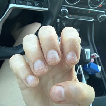 Pureluxe Nail Spa - My nails after removal. - Nail Salons Near Me - Frisco, Colorado Pureluxe Nail Spa - My nails after removal. - Nail Salons Near Me - Frisco, Colorado