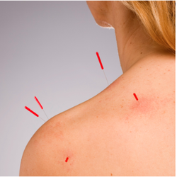 Three Harmonies Acupuncture