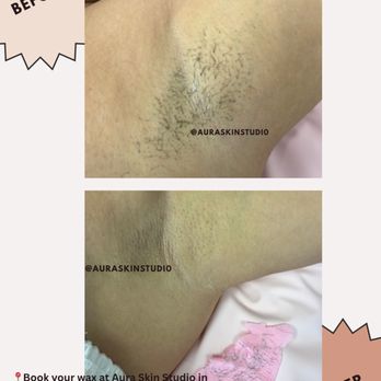 Aura Skin Studio - Underarm Waxing - Estheticians Near Me - Lutz, Florida