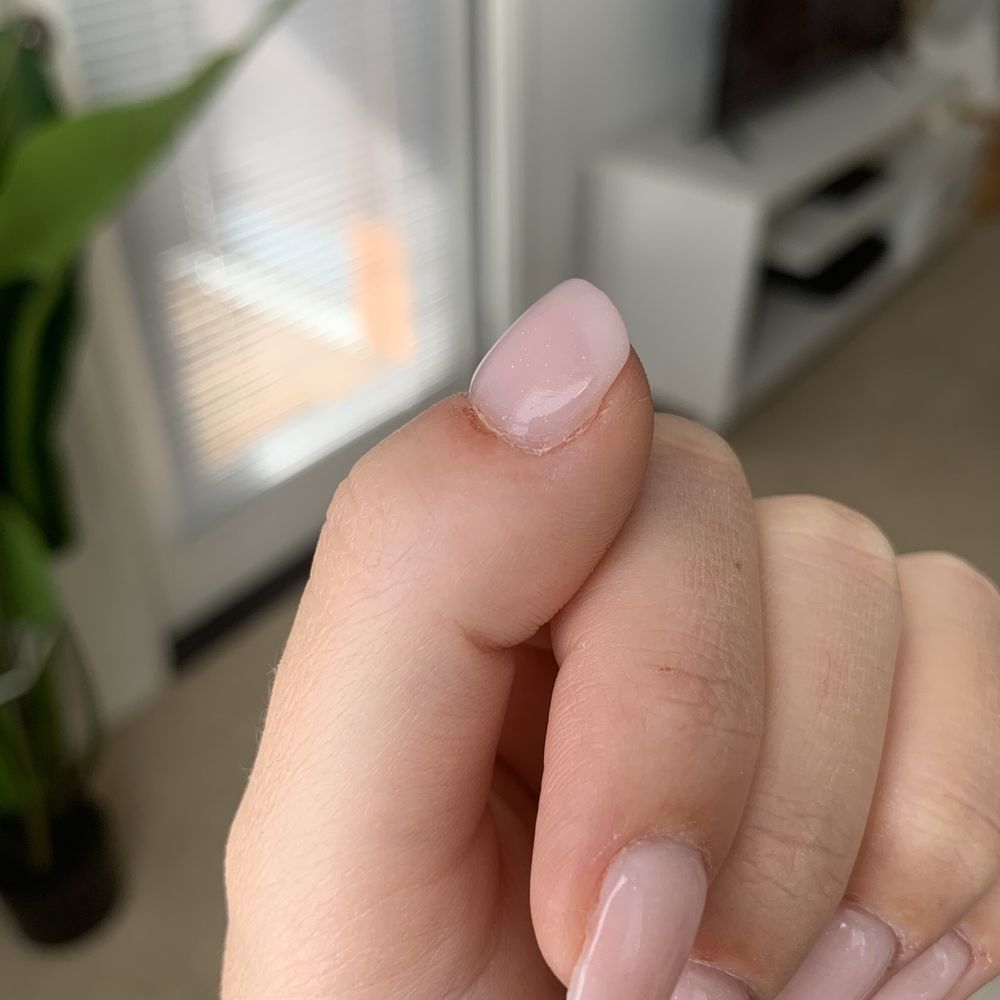 Happy Nails and Spa - Infected cut-open cuticles on EVERY single finger. - Nail Salons Near Me - Irvine, California Happy Nails and Spa - Infected cut-open cuticles on EVERY single finger. - Nail Salons Near Me - Irvine, California
