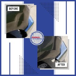 Dent Clinic - Dent Repair - Before & After