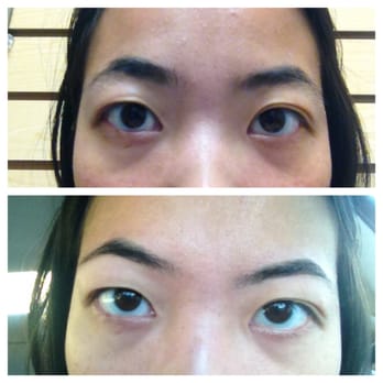 Rani Threads Magic - BEFORE (top) & AFTER (bottom) Sorry for scary photo. Rani works magic! - Threading Services Near Me - San  Francisco, California