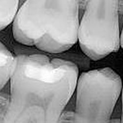 White Mountain Dental - Rock Springs Dentist