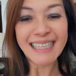 my beautiful teeth after i get my braces done at Dr Christopher H Nguyen !!