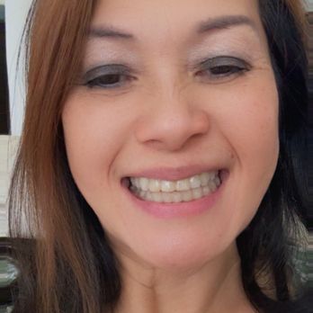 Christopher H Nguyen, DMD, MSD - my beautiful teeth after i get my braces done at Dr Christopher H Nguyen !! - Orthodontists Near Me - Santa Ana, California