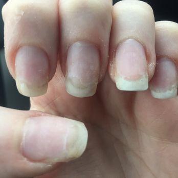 Classic Nails - Left hand (see all the cuticles?) - Nail Salons Near Me - King of Prussia, Pennsylvania Classic Nails - Left hand (see all the cuticles?) - Nail Salons Near Me - King of Prussia, Pennsylvania