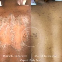 Glam718 Salon & Spa - 100% Organic body peel , no chemicals . Can be used on any area of the body including intimate, lightning, hyperpigmentation, scars,