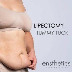 Ensthetics - Aesthetic Surgery - Liposuction and tummy tuck in Ensenada for a slimmer waist and flatter abdomen.