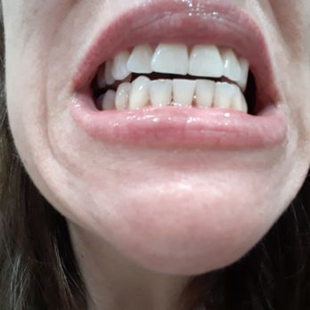 Artistic Dentistry - Dr. Farrah Nikraz cleans so gently & thoroughly & she is so fun & easy to talk to, just a true friend & true doctor! Amazing! Superior Skill - General Dentistry Near Me - San Clemente, California Artistic Dentistry - Dr. Farrah Nikraz cleans so gently & thoroughly & she is so fun & easy to talk to, just a true friend & true doctor! Amazing! Superior Skill - General Dentistry Near Me - San Clemente, California