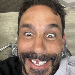 Aliso Viejo, CA Cosmetic Dentist - Dr. E. John Moreno - Before!