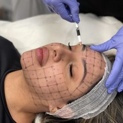 Bodylase Med Spa - Thermage
