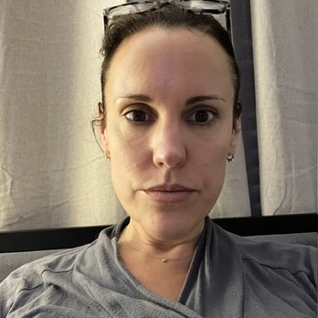 Skin Med Spa - 2023, no filters - Medical Spas Near Me - Downers Grove, Illinois Skin Med Spa - 2023, no filters - Medical Spas Near Me - Downers Grove, Illinois