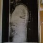 Roberto Rolando F MD Orthopaedic Surgery Spine