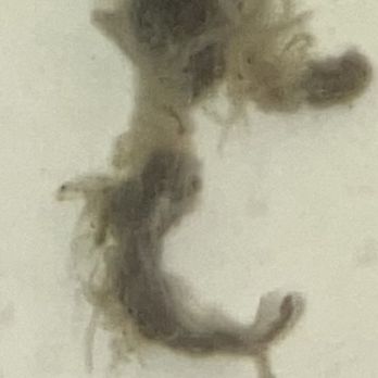 Colon and Rectal Clinic - Dr. refuse treatment on patient ignoring pleas for help with dehabilitating virus - Surgeons Near Me - Las Vegas, Nevada Colon and Rectal Clinic - Dr. refuse treatment on patient ignoring pleas for help with dehabilitating virus - Surgeons Near Me - Las Vegas, Nevada