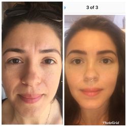 Devilash - New mommy. She time for make up. My brows Microblading make her get ready in a minute. Natural , fuller and perfect shape for her brows.