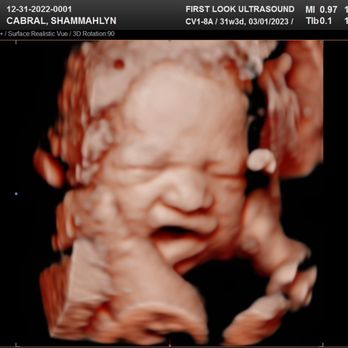 First Look Ultrasound - Diagnostic Imaging Near Me - Kaneohe, Hawaii