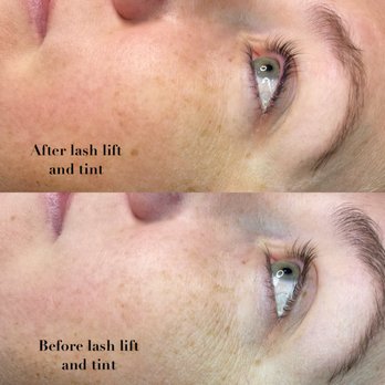 M Spa - Laser Hair Removal Near Me - Boise, Idaho M Spa - Laser Hair Removal Near Me - Boise, Idaho