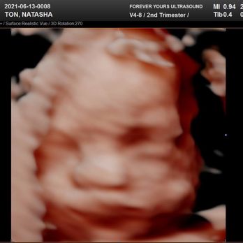 Forever Yours Ultrasound - Ultrasound Imaging Centers Near Me - Fullerton, California