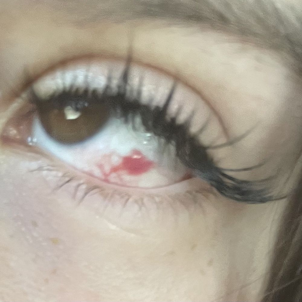 Mini Beauty Eyelash - Eye damage - Eyelash Service Near Me - Chino, California Mini Beauty Eyelash - Eye damage - Eyelash Service Near Me - Chino, California